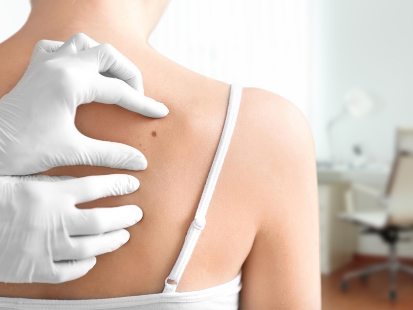 Kožní ambulance - MUDr. Jana Klímová